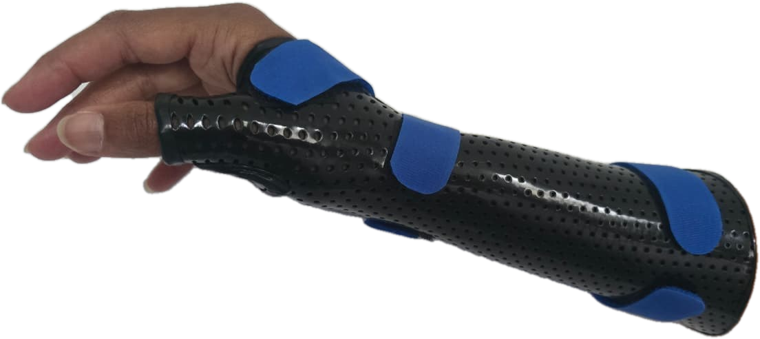 Orthèse thermoformée sur mesure du poignet et de la main, thermoplastique noir perforé et sangles bleues — réalisation de Jolan Dupont